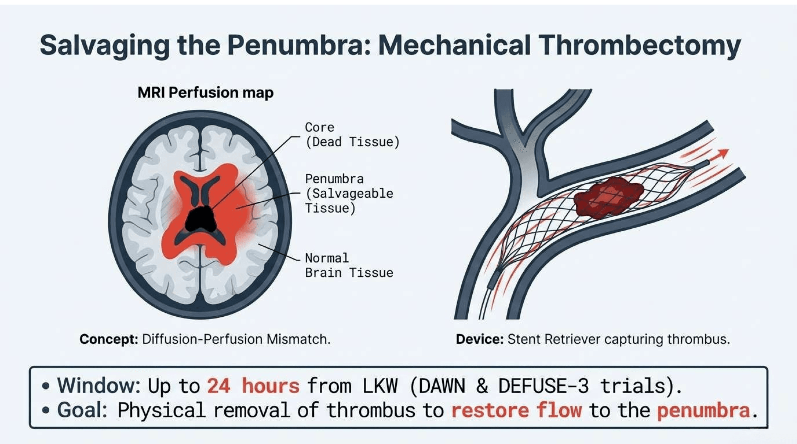 Slide 12 of Time is Brain: Protocols for Acute Ischemic Stroke Management
