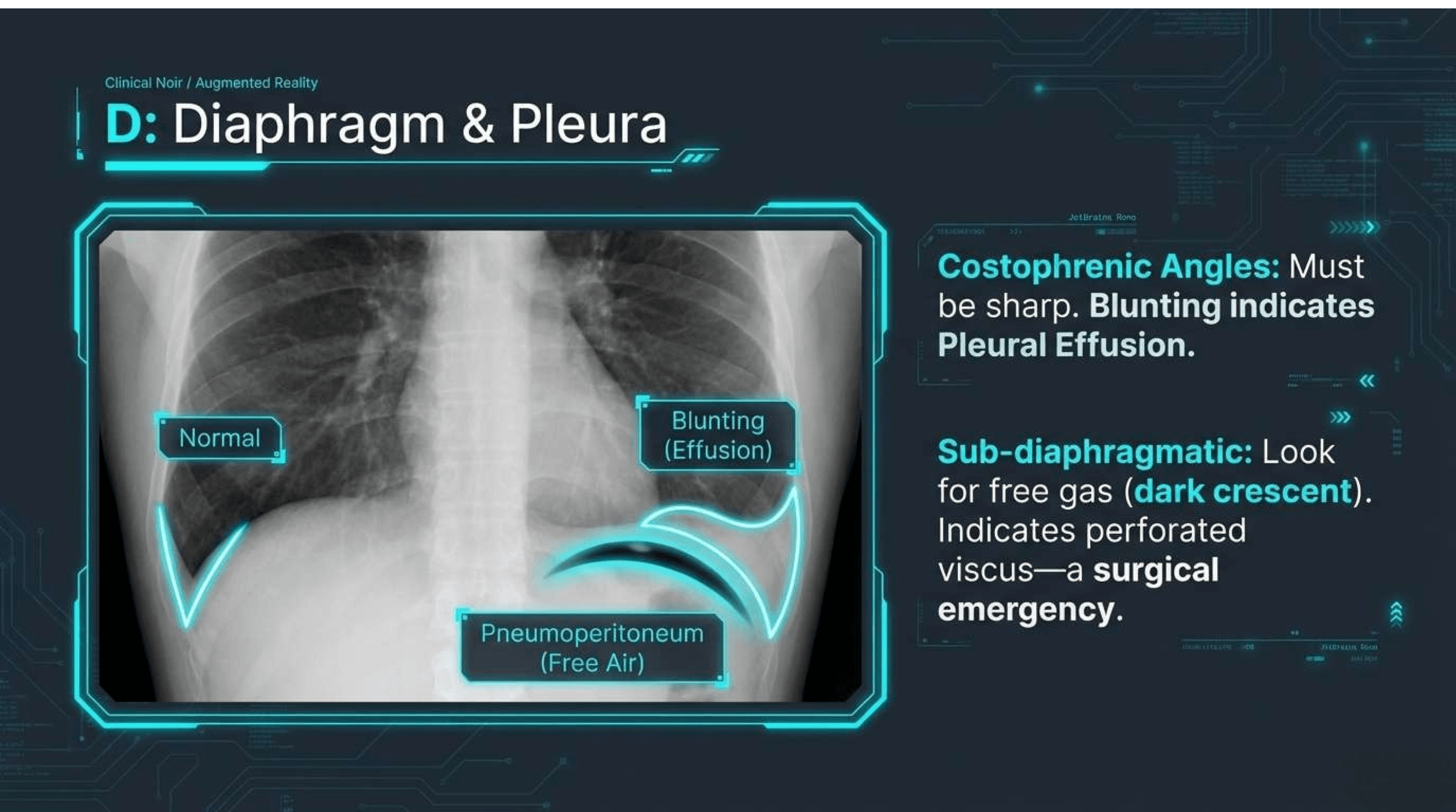 Slide 9 of CXR Interpretation: Reading Between the Ribs