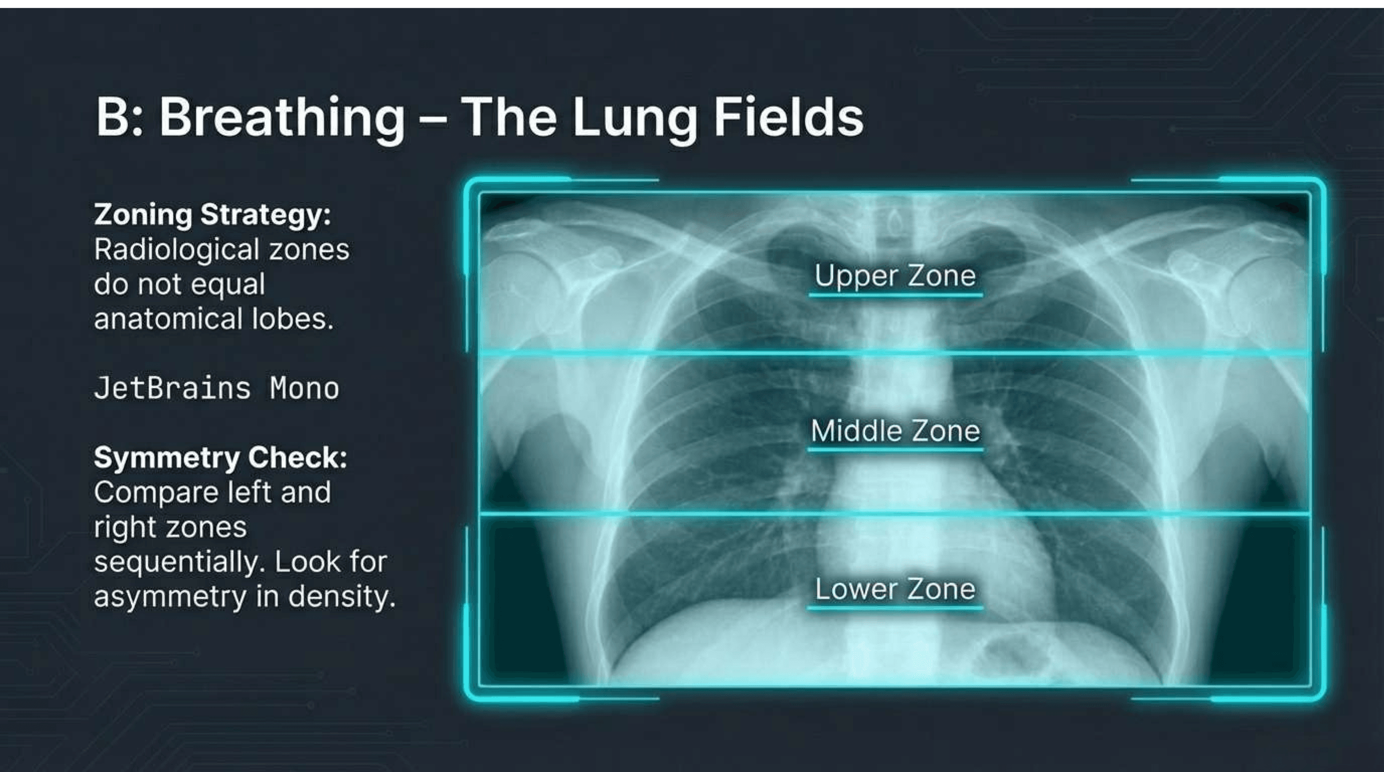 Slide 5 of CXR Interpretation: Reading Between the Ribs