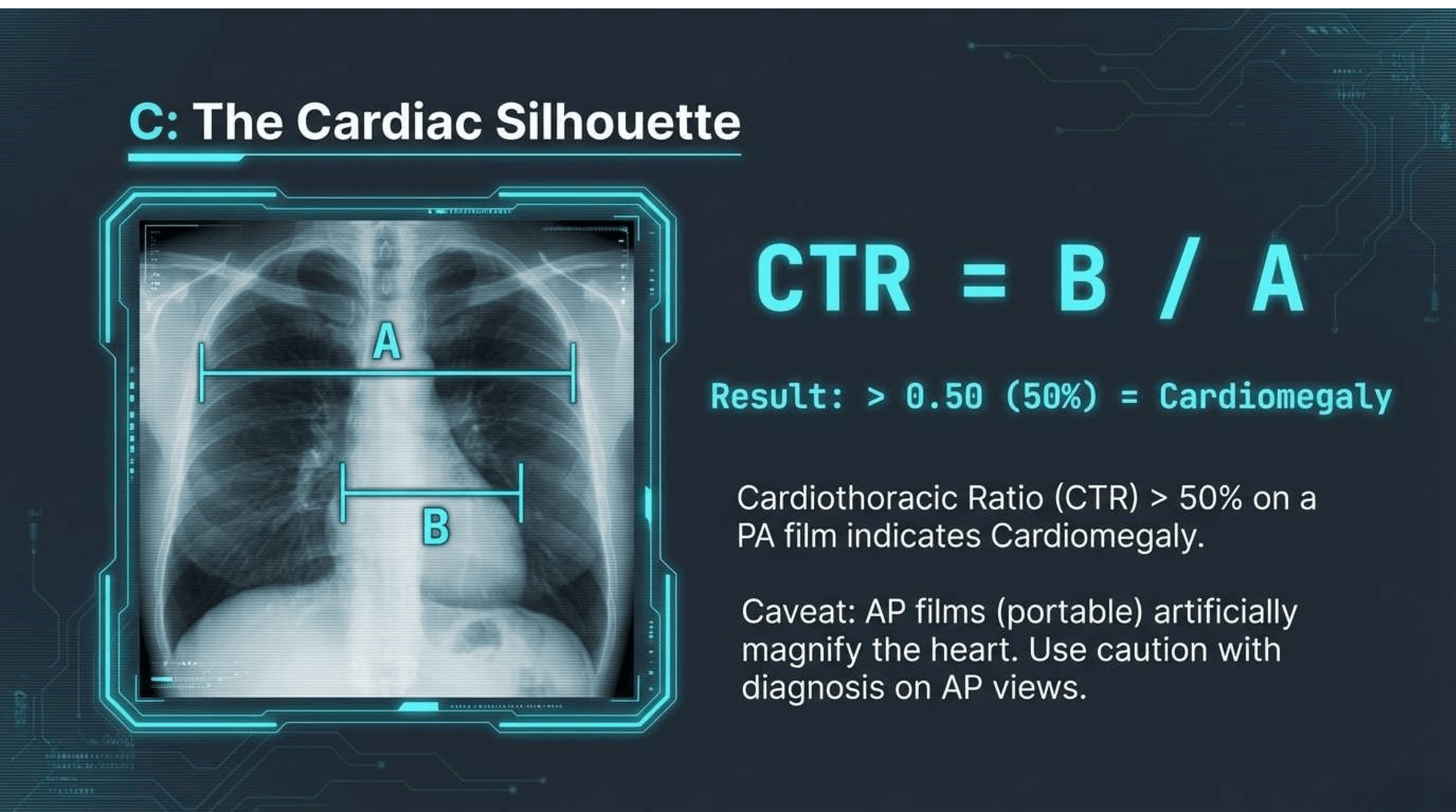 Slide 7 of CXR Interpretation: Reading Between the Ribs
